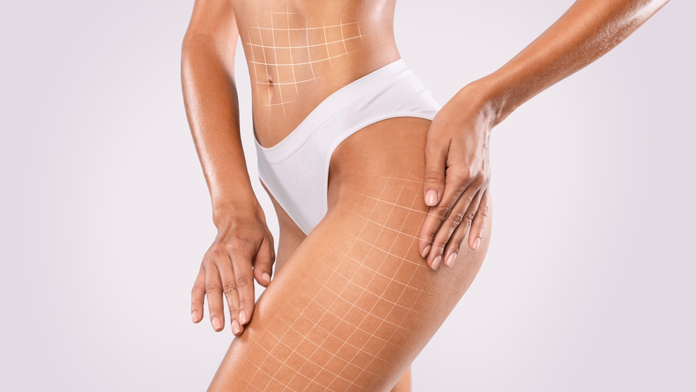 How Long Can Liposuction Results Last in DC?