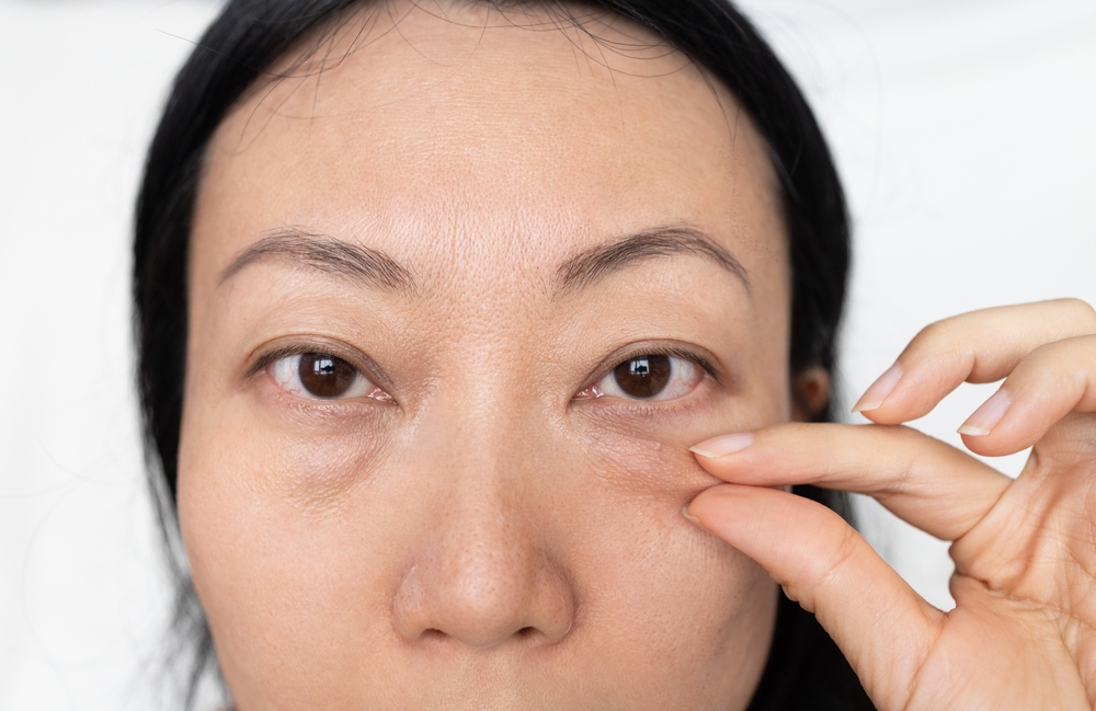 Eyelid Surgery Cost in Georgetown: How Much Is Blepharoplasty?