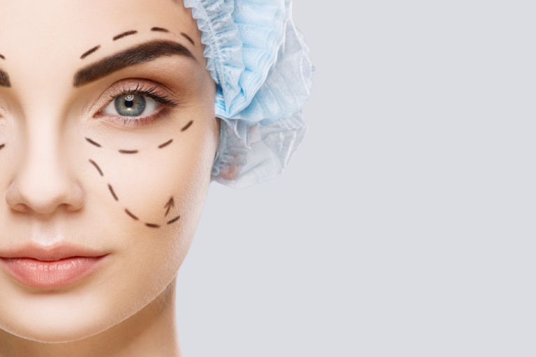 Blepharoplasty Surgery in DC