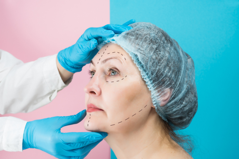 Best Deep Plane Facelift Surgery Cost in DC