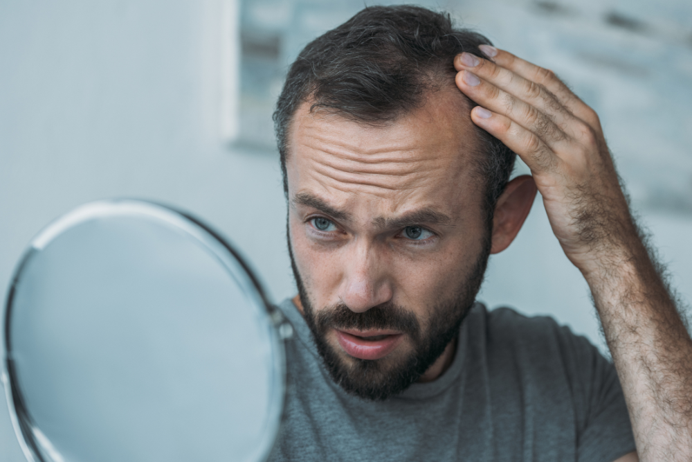 Best Hair Loss Treatments in DC