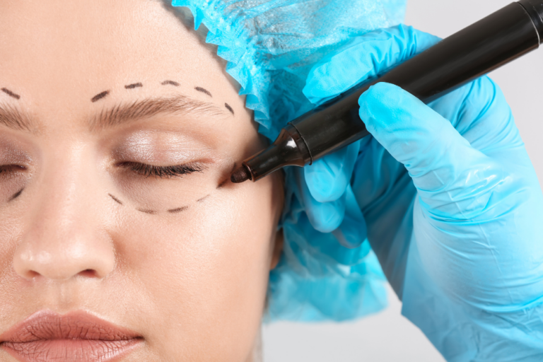 Eyelid Surgery Financing in DC