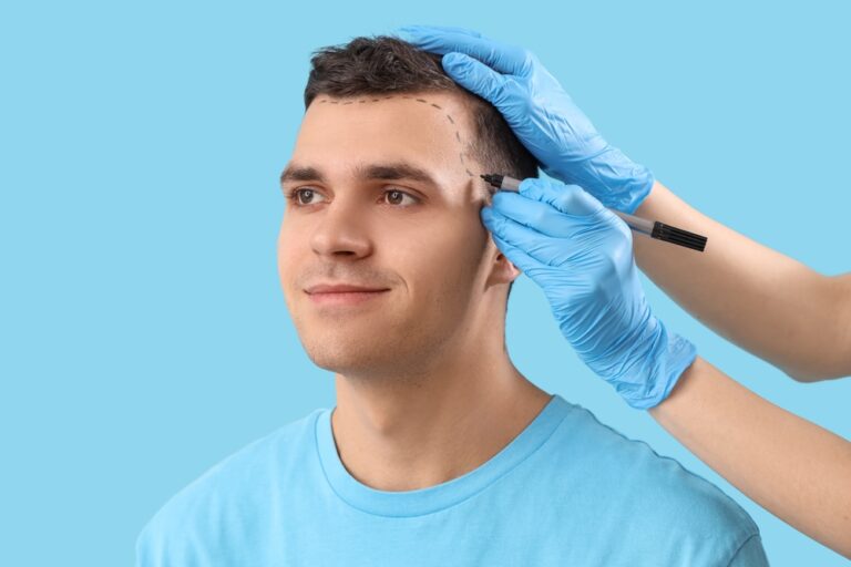 Top-Rated Clinics for Hair Transplant Consultations in the DC Metro Area