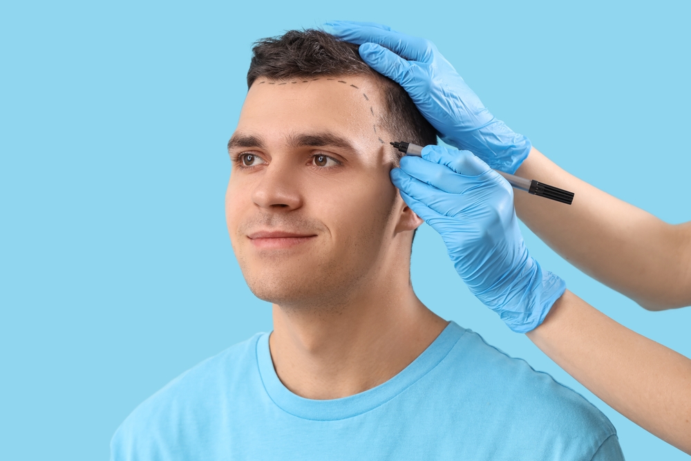 Top-Rated Clinics for Hair Transplant Consultations in the DC Metro Area