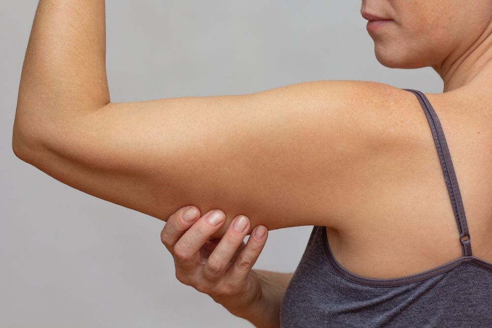 Preparing for Arm Lift and Thigh Lift Surgery Consultations in Washington, DC