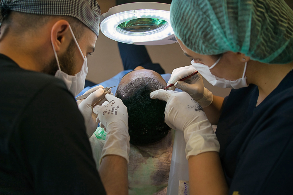 Key Differences Between FUE and FUT Hair Restoration Techniques