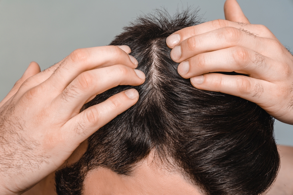 Hair Restorative Pricing Washington DC