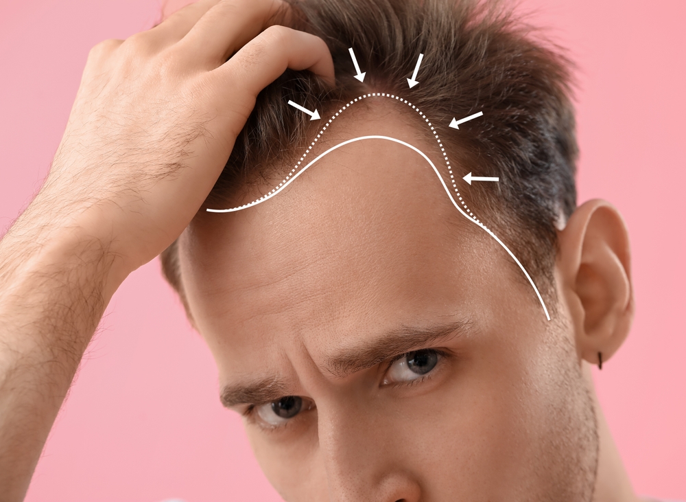 Best Hair Loss Doctor in DC