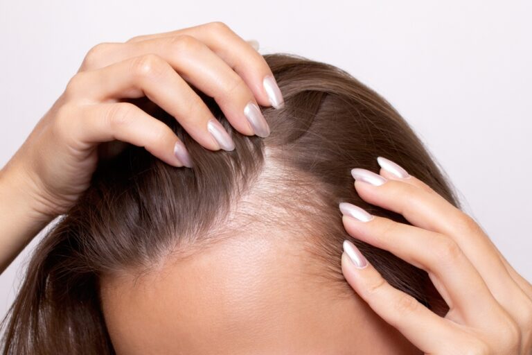 Best Hair Loss Doctors in Washington D.C. Offering Advanced FUE and FUT Transplants