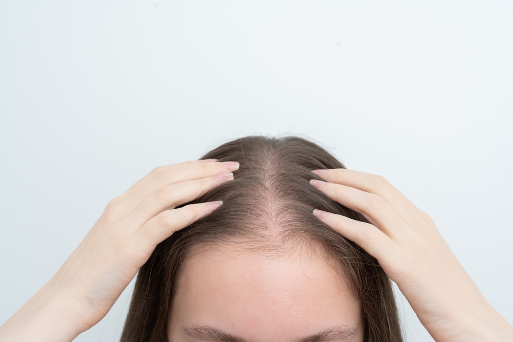 Best Doctor for Hair Loss Consultations in Washington, DC