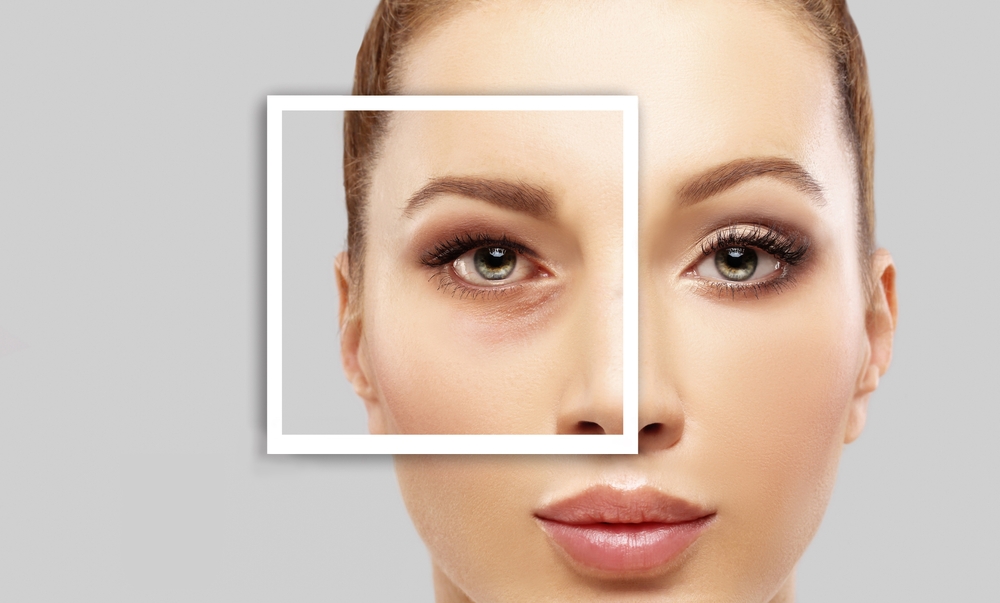 Eyes on the Prize: Average Pricing for Revision Eyelid Surgery Near Dupont Circle, DC