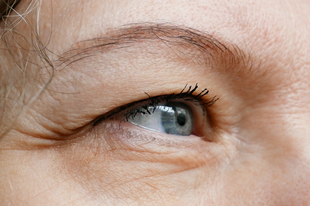 Mini Eyelid Surgery Pricing at a Consultation Near Georgetown
