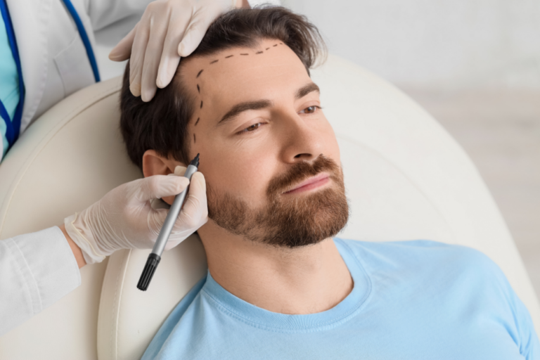 Hair Transplant Consultation for Hair Restoration in Washington, DC