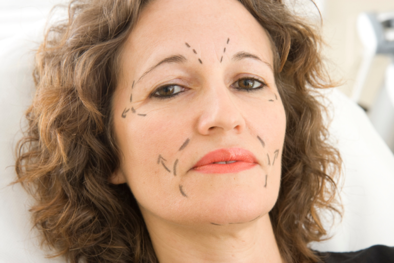 Facelift Surgery Cost in Washington, DC