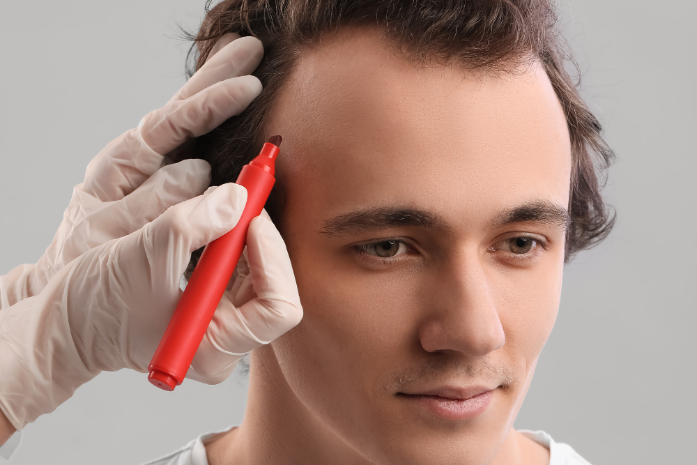 Best Hair Restoration Transplant Options in Washington, DC
