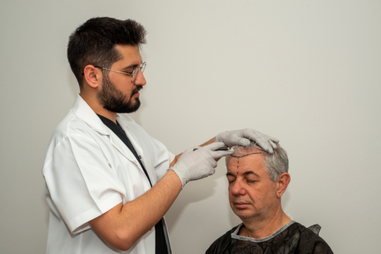 Hair Transplant Cost and Pricing in Washington, DC