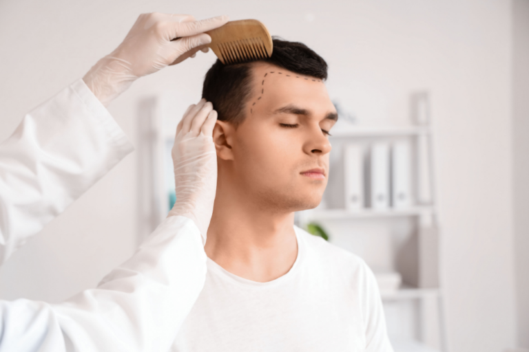 Complimentary Hair Loss Consultation in Washington, DC