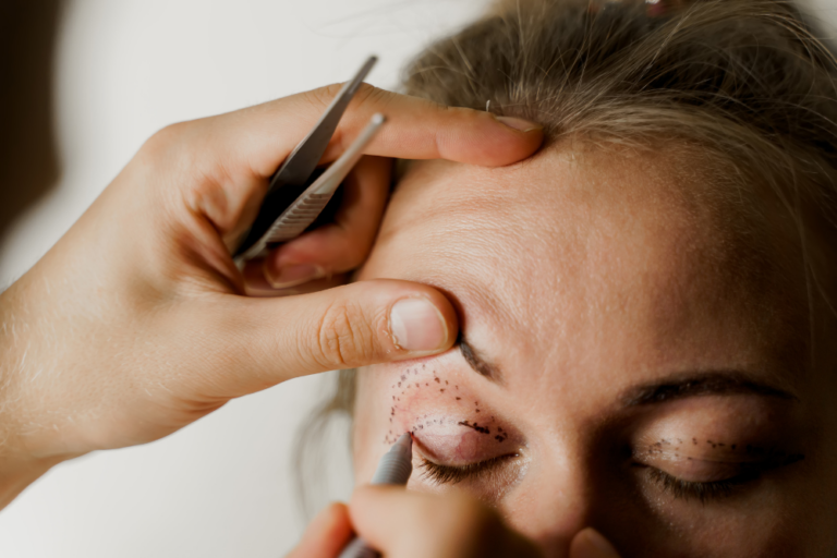 Eyelid Surgery Cost Upper and Lower Blepharoplasty in Washington, DC
