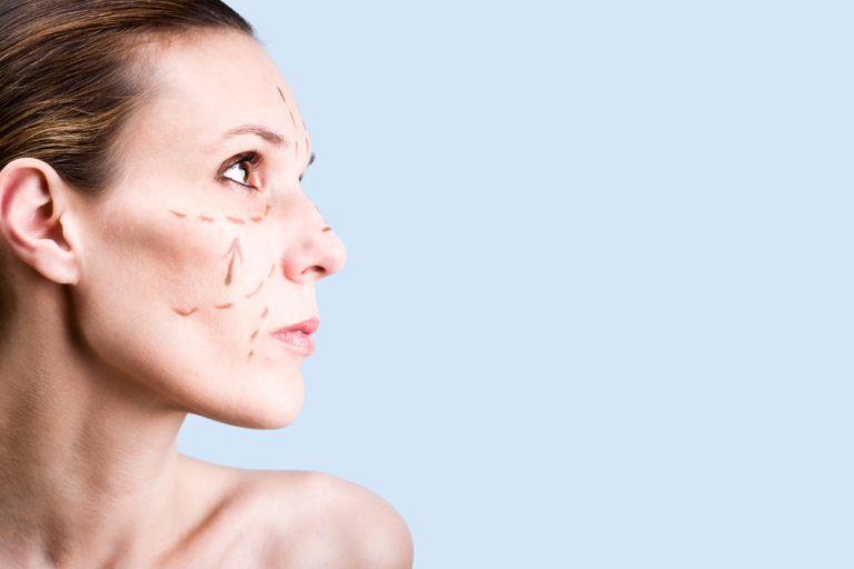 Facelift Surgery Cost and Recovery in Washington, DC