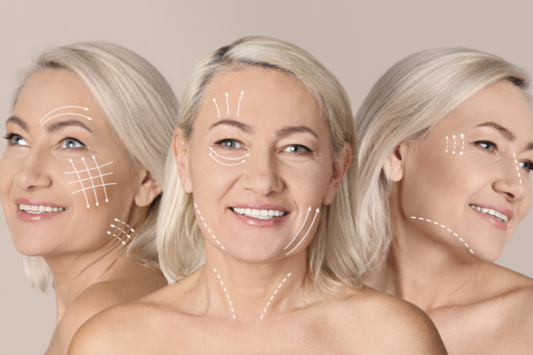 Facelift and Neck Lift Combination Surgery in Washington, DC