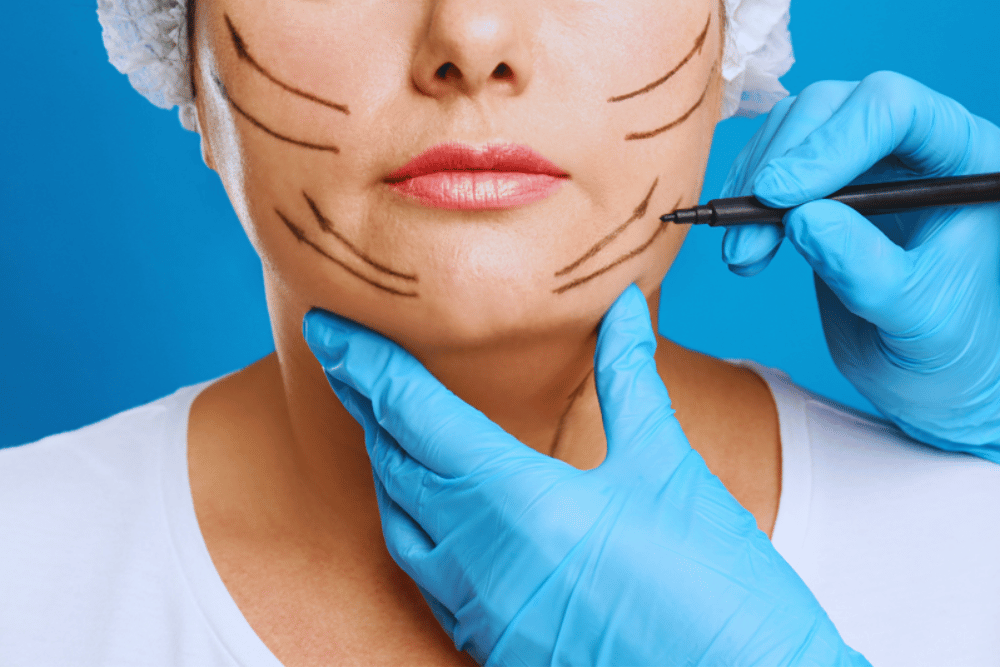 Deep Plane Facelift Surgeon in Washington DC
