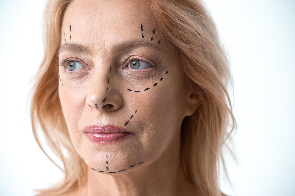 Best Facelift Surgeon in Georgetown, Washington, DC