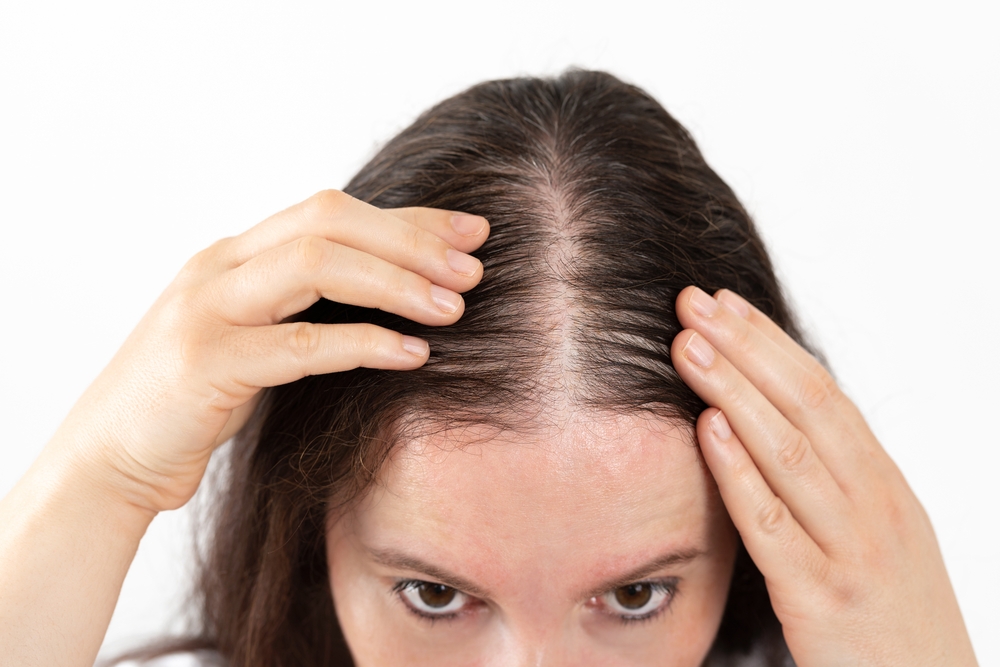 Best Hair Restoration Specialist in Washington DC for Thinning Hair
