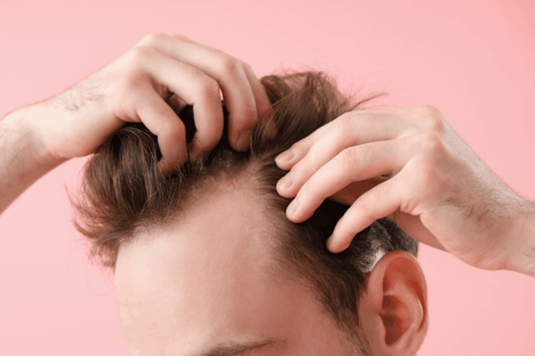 Hair Transplant Cost Washington DC