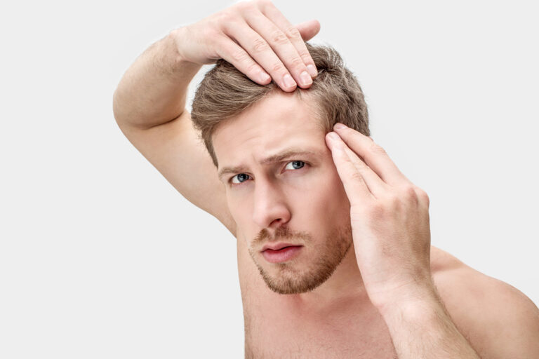 man wondering if he's too young for a hair transplant in DC