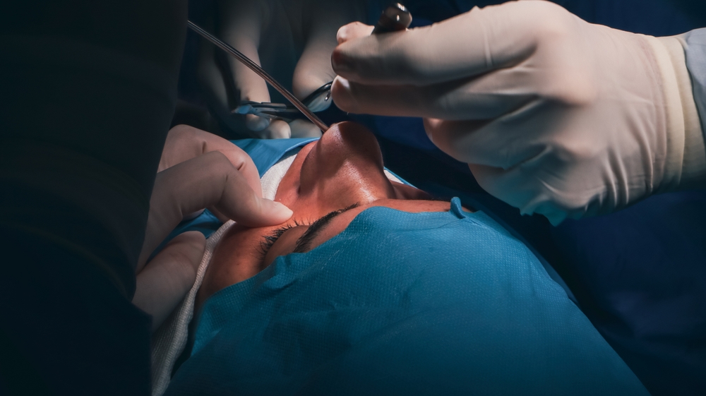 nose reshaping surgery in Washington DC