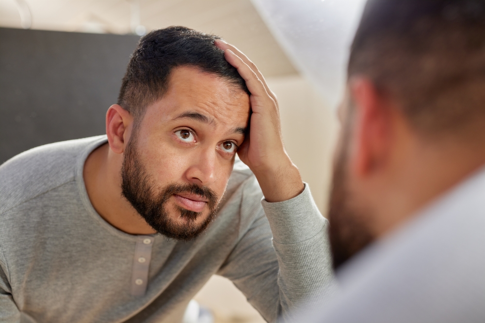 man wondering if hair loss is temporary or permanent
